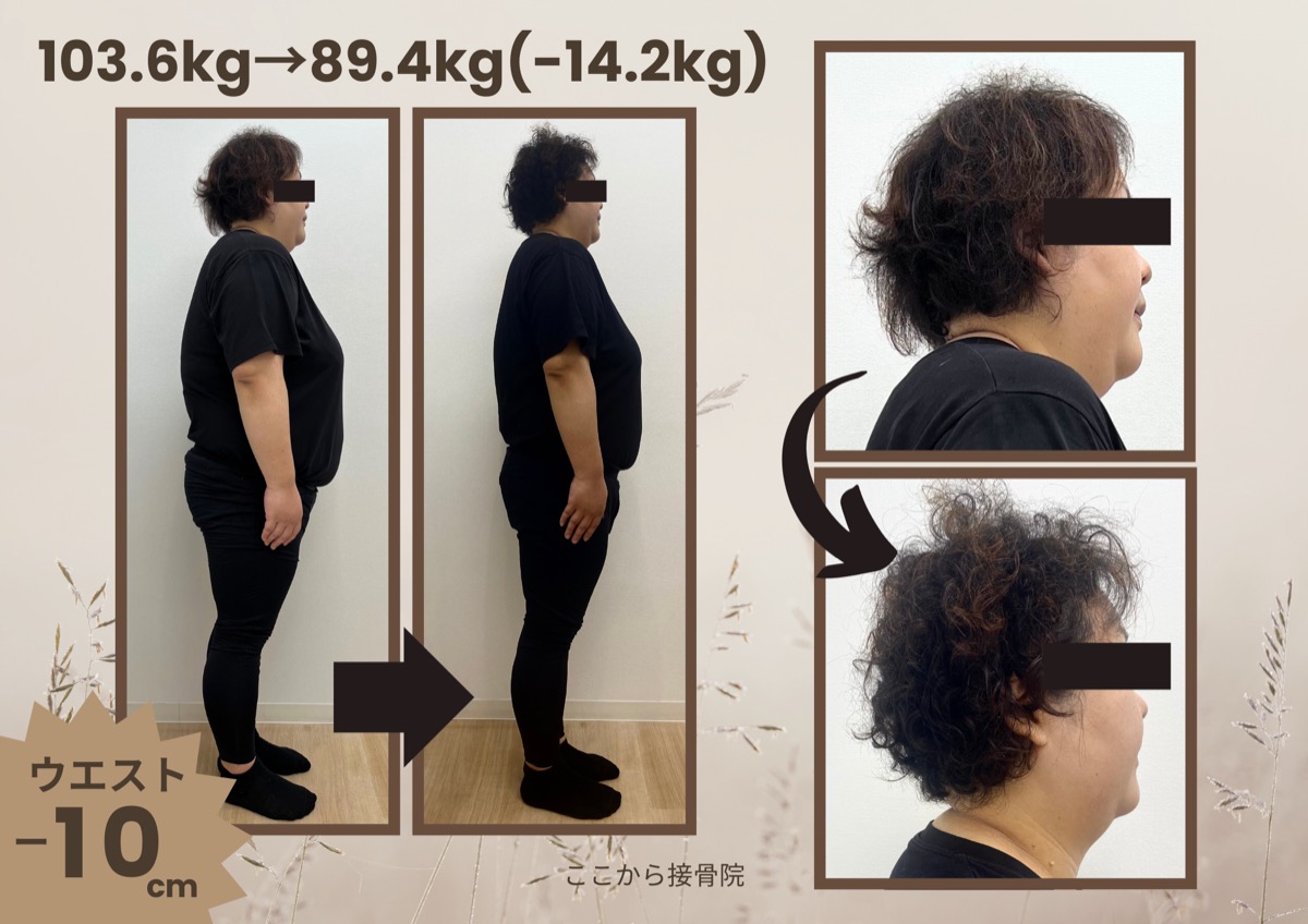 A.O様 ビフォーアフター（横）