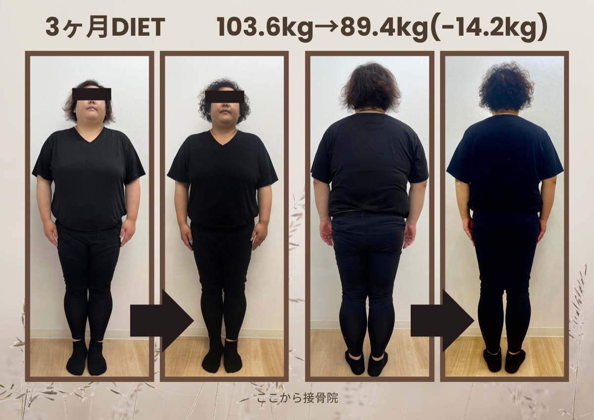 A.O様 ビフォーアフター（正面）