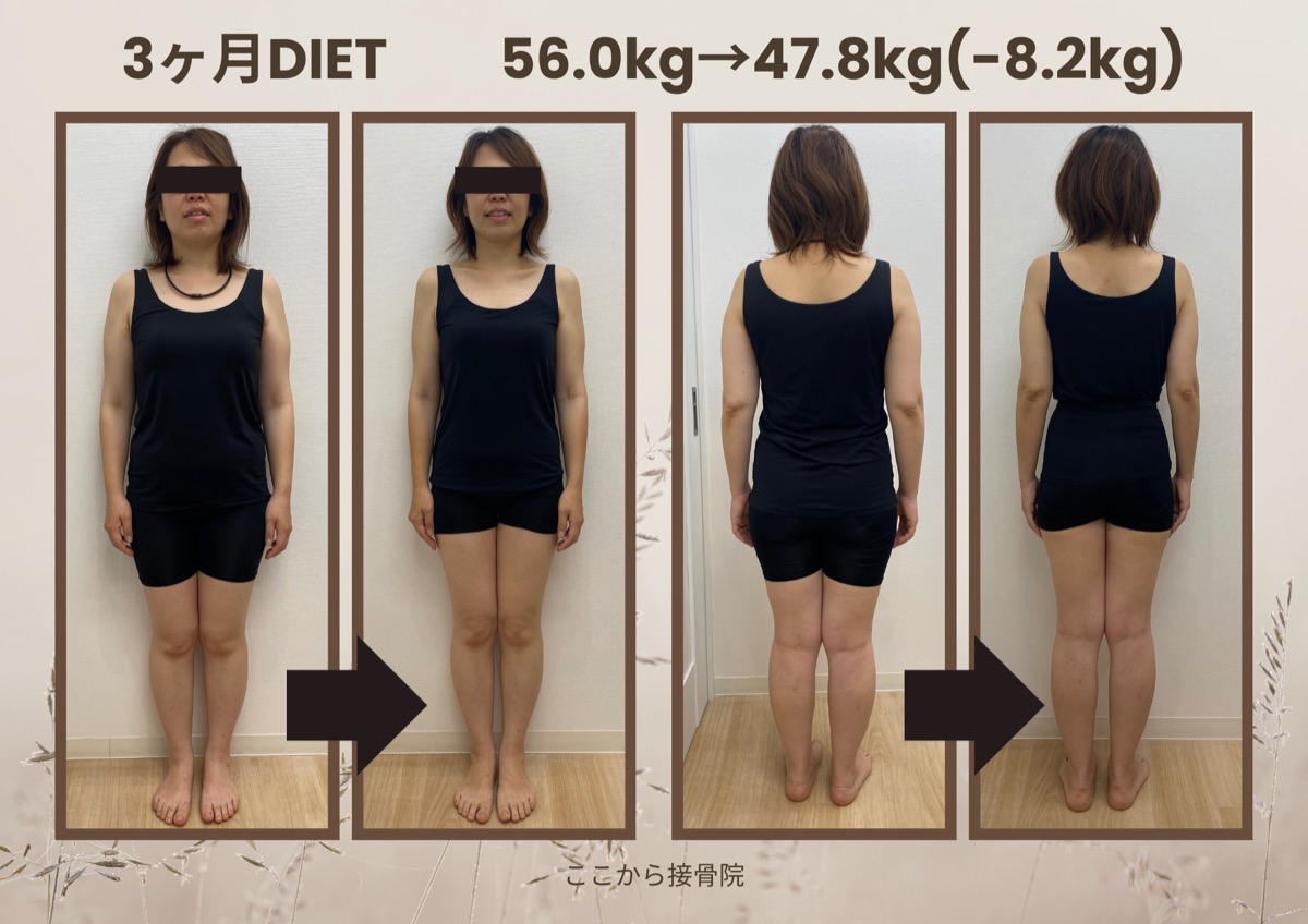 O様 ビフォーアフター（正面）