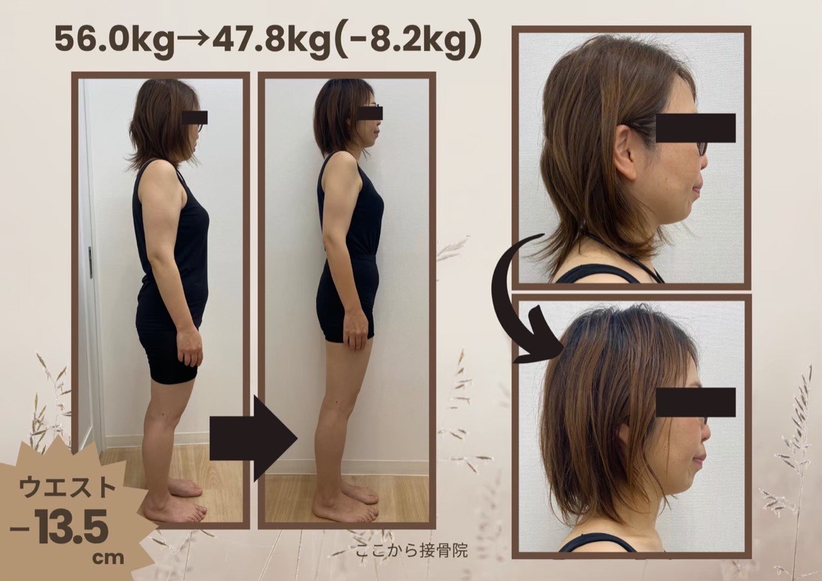 O様 ビフォーアフター（横）