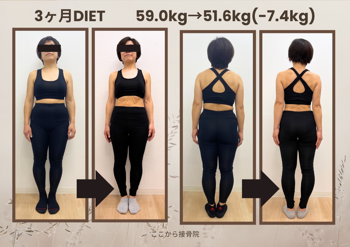 S様 ビフォーアフター（正面）