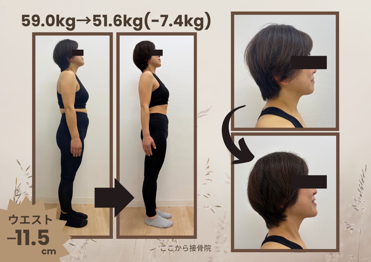 S様 ビフォーアフター（横）