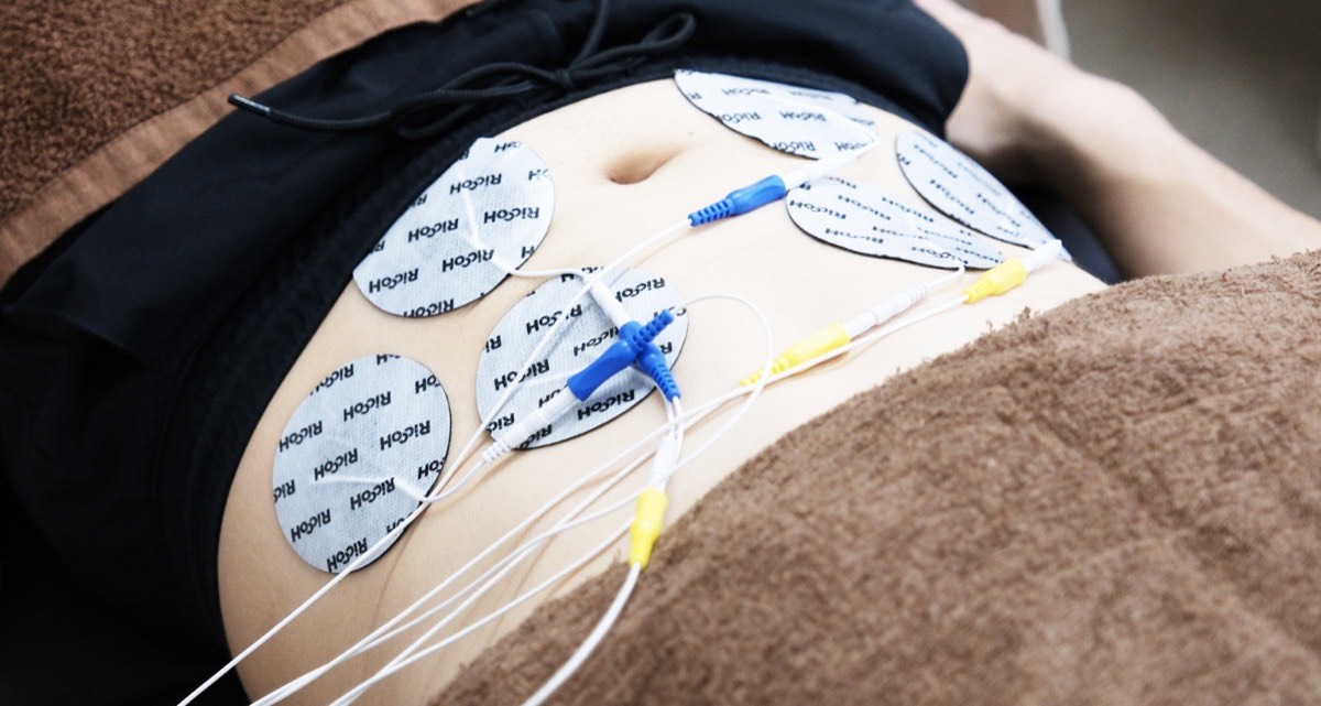 複合高周波EMS施術の様子